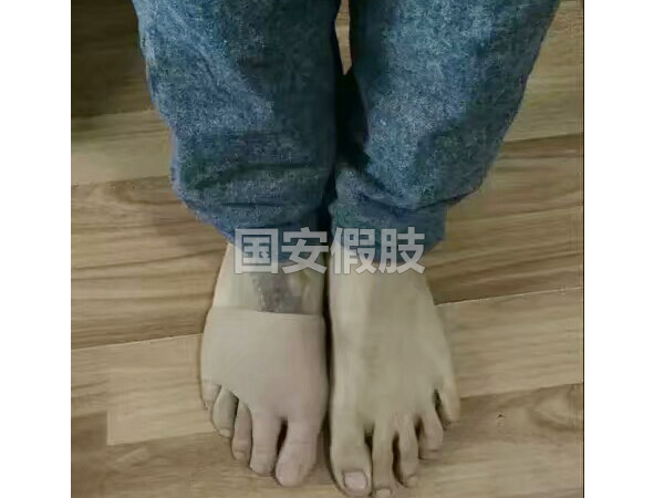 長(zhǎng)沙國(guó)安假肢康復(fù)用品有限公司,長(zhǎng)沙假肢用品,國(guó)安假肢康復(fù)用品,假肢矯形器,康復(fù)器材,假肢配件,矯形器支具