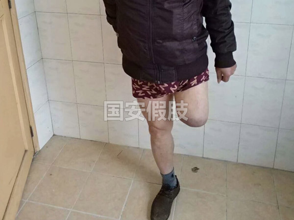 長沙國安假肢康復(fù)用品有限公司,長沙假肢用品,國安假肢康復(fù)用品,假肢矯形器,康復(fù)器材,假肢配件,矯形器支具