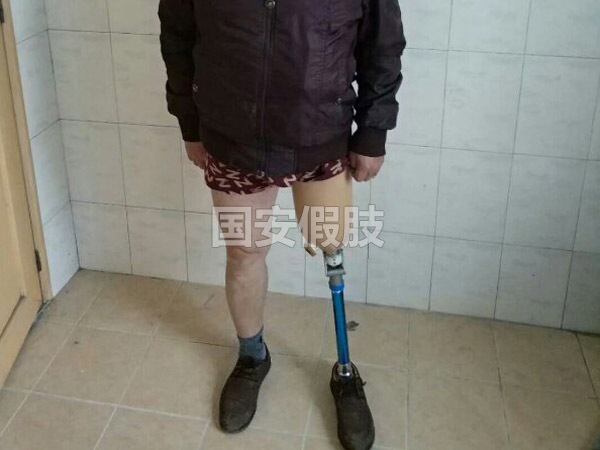 長沙國安假肢康復(fù)用品有限公司,長沙假肢用品,國安假肢康復(fù)用品,假肢矯形器,康復(fù)器材,假肢配件,矯形器支具