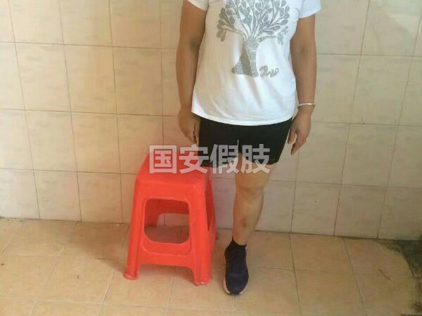 長(zhǎng)沙國(guó)安假肢康復(fù)用品有限公司,長(zhǎng)沙假肢用品,國(guó)安假肢康復(fù)用品,假肢矯形器,康復(fù)器材,假肢配件,矯形器支具