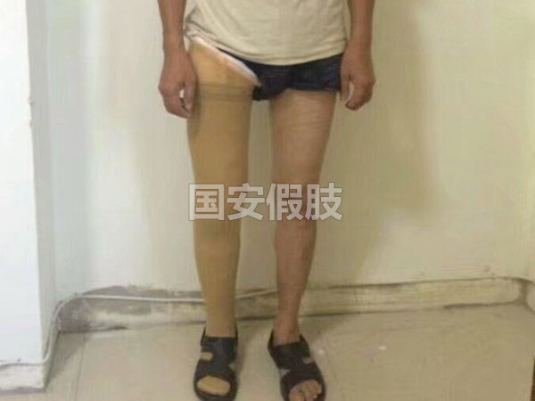 長(zhǎng)沙國安假肢康復(fù)用品有限公司,長(zhǎng)沙假肢用品,國安假肢康復(fù)用品,假肢矯形器,康復(fù)器材,假肢配件,矯形器支具